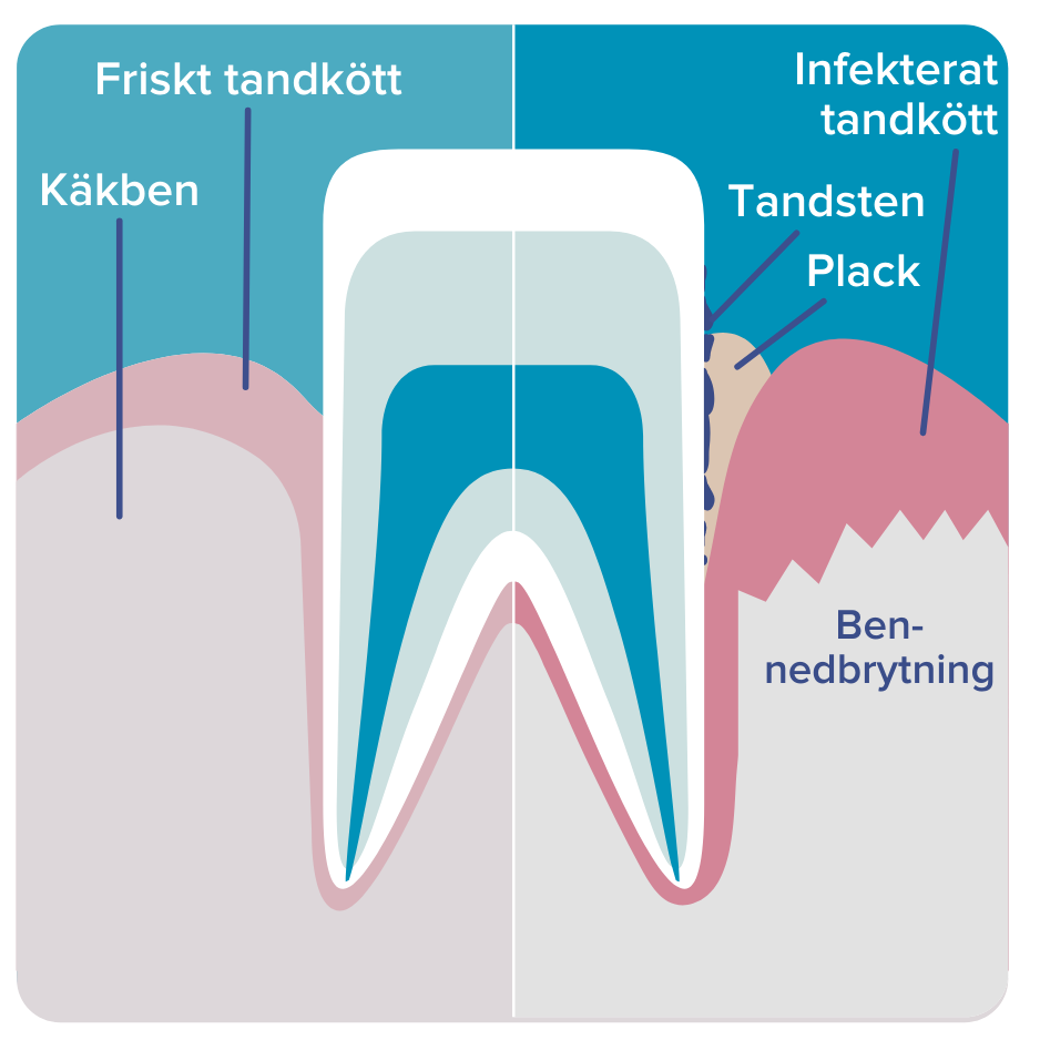 Anatomi av en tand och beskrivning